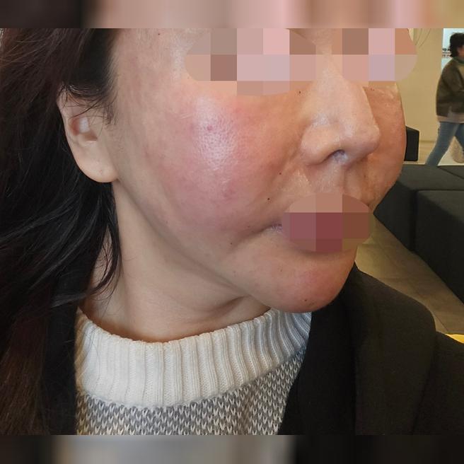정품정량에 수면이라 기분 좋게 받고 가족도 모시고 오려고요 ㅎㅎ