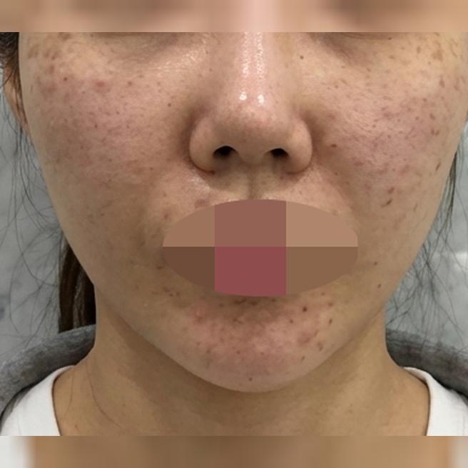 빠른 대응에 친절함까지, 리쥬란 이번에도 잘 받아봤어요ㅎ
