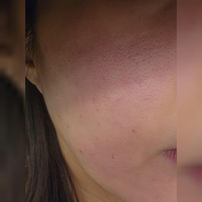 3회 패키지 1회차인데 벌써 효과가 기대됩니다ㅎㅎ~