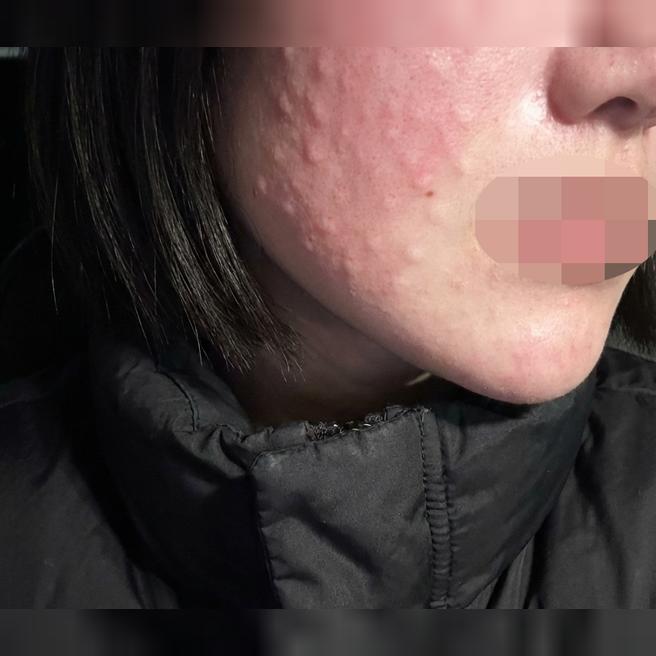 긴장하고 갔는데 다들 친절해서 편하게 받은 것 같아요 ㅎㅎ