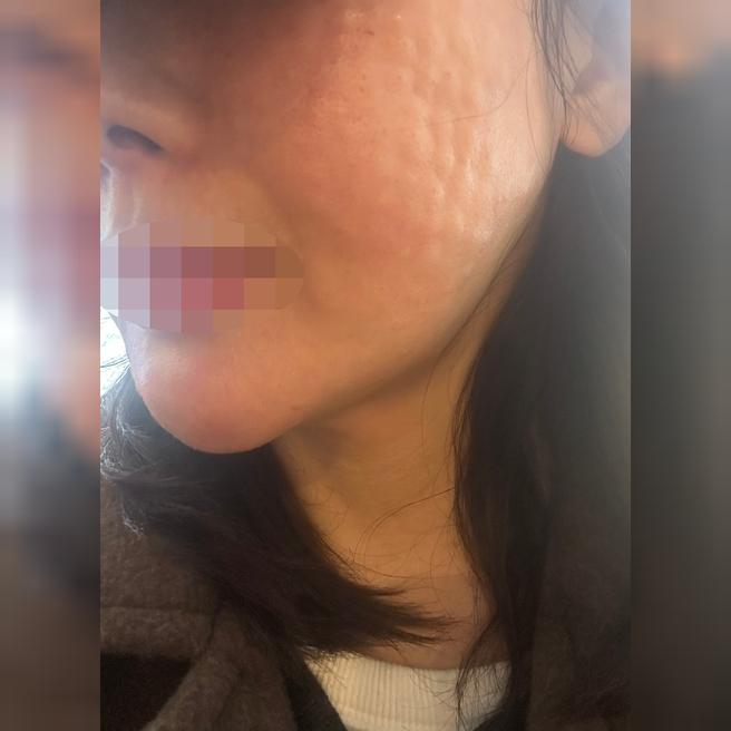 속건조 때문에 받았는데 리쥬란은 꼭 여기서 받을려고요!