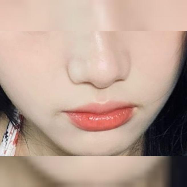 맞은 지 3주 됐는데 피부에서 빛이 나요…쥬베룩 인정이에요