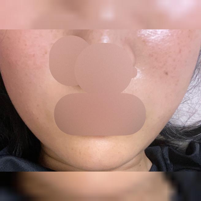 윤기 있는 피부 만들고 싶어 방문, 친절한 응대 덕분에 만족스러웠어요~