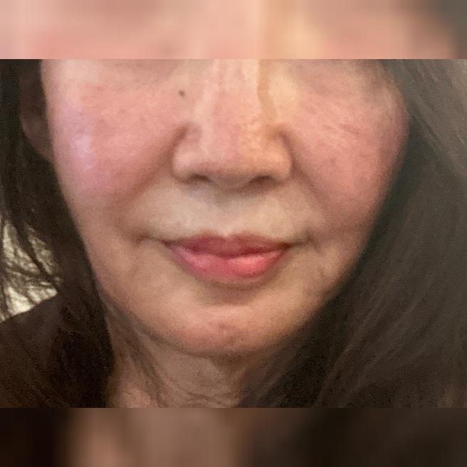 모피우스8 1주 후 솔직 후기, 만족스러운 변화