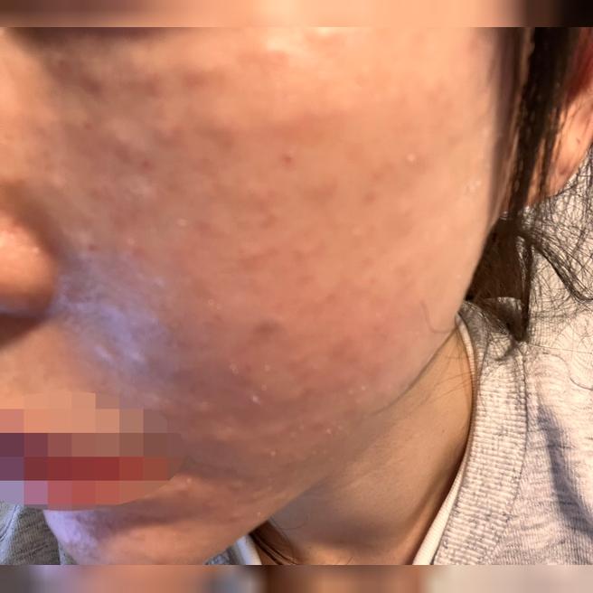 리즈네 받았는데 건조함 잡히고 친절해서 좋았어요 ㅎㅎ