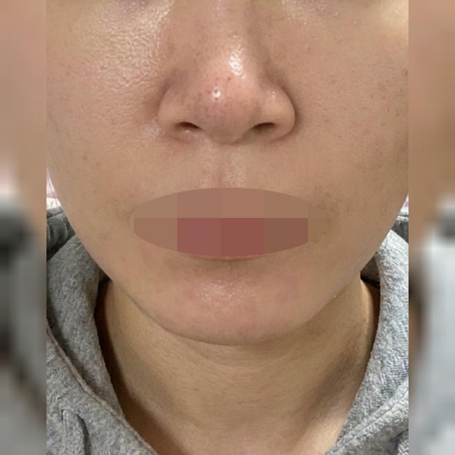 직접 알아보고 결정한 샤넬주사, 친절한 응대까지 만족이에요ㅎㅎ