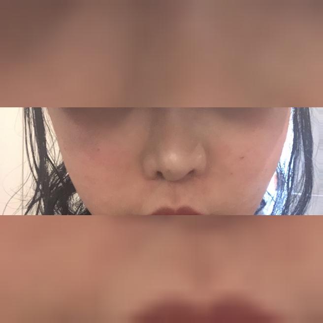 꼼꼼하게 시술해주고 정품 인증까지, 믿고 다니는 곳이에요