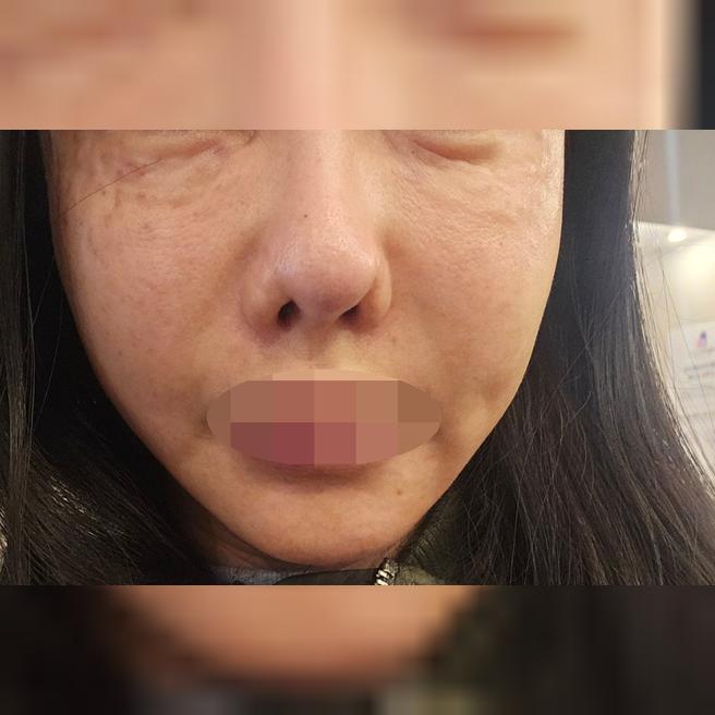  눈밑 건조했는데 받고 나니까 바로 좋아지고, 친절하고 꼼꼼해서 항상 여기만 다니는 것 같아요~
