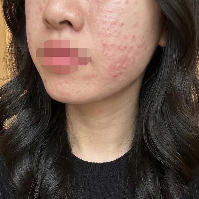 일본어 통역 가능하고 리쥬베룩 받아서 효과 기대돼요~