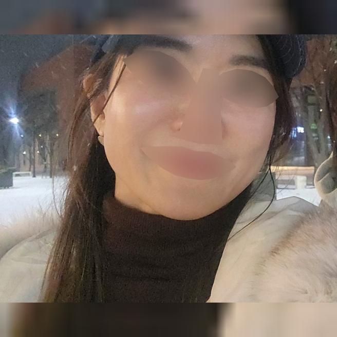 푸석한 피부가 신경 쓰여서 받았어요