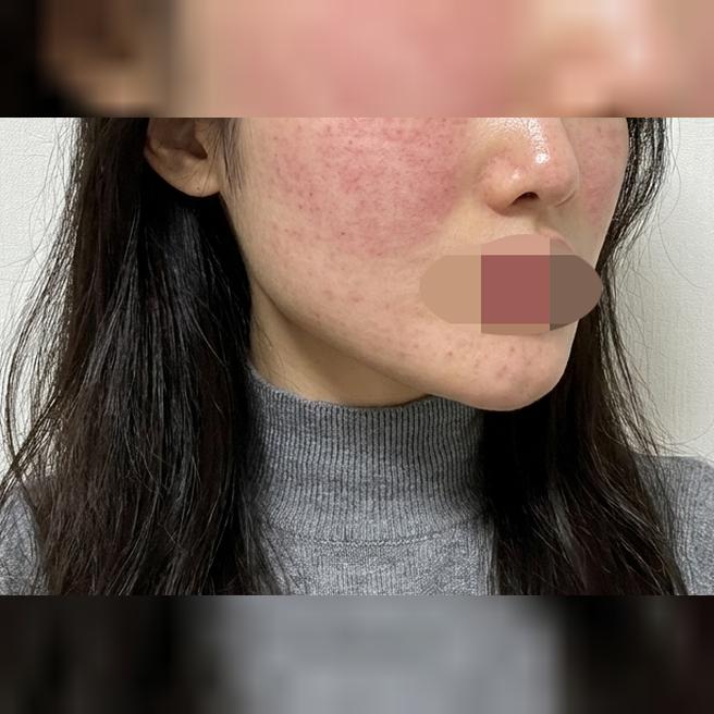 화장할 때마다 스트레스던 피부, 리쥬베룩으로 케어 시작했어요~