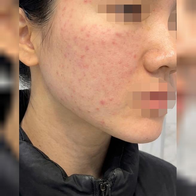 전문적인 설명 마음에 들고 병원도 친절해서 추천해요 ㅎㅎ