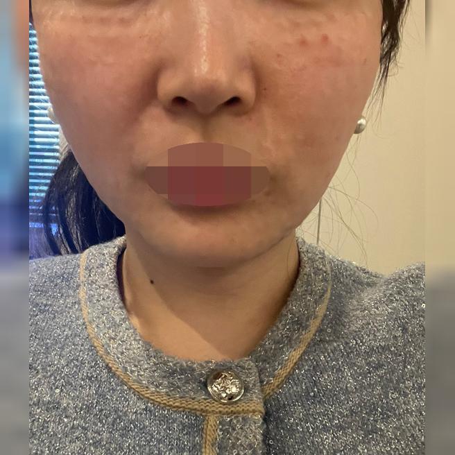 겨울이라 건조해서 받았는데 어플 가격 동일하고 수면이라 편하게 받았어요~꼼꼼하게 해주신 것 같네요ㅎㅎ