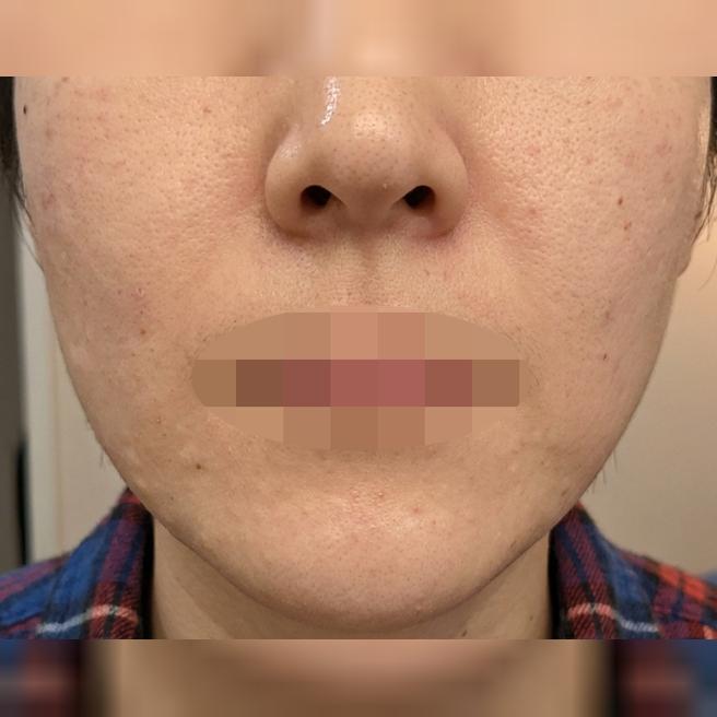 2일 차부터 속부터 느낌 다른 리쥬베룩, 받길 잘했습니다.