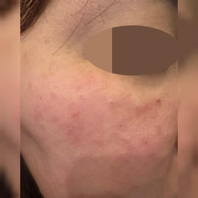 포텐자 걱정했는데 친절한 상담에 편하게 잘 받았어요~