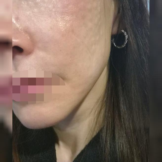 병원 깔끔하고 응대 빨라서 좋은 것 같아요~ 엠보도 꼼꼼해서 좋아요!