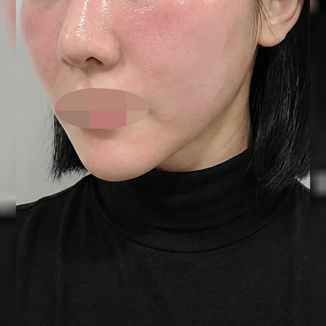 화장이 예전처럼 안 먹히더니 엑소좀으로 다시 진행했어!