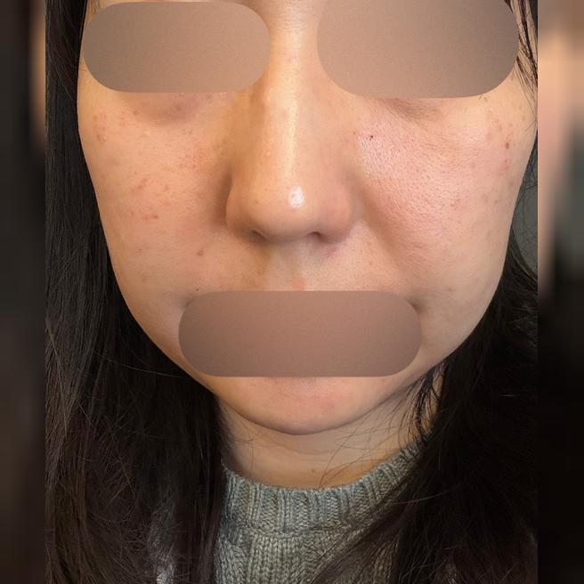 만족도 높아서 매번 이용 중이에요~추가 강요 없고 제 얼굴에 맞게 제안해줘서 좋아요!