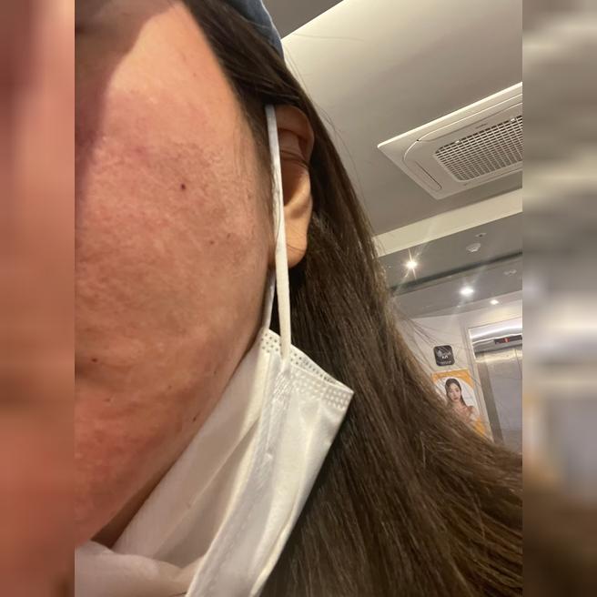 왜 이제 했나 싶은 시술! 리쥬란 웨딩 준비 후기