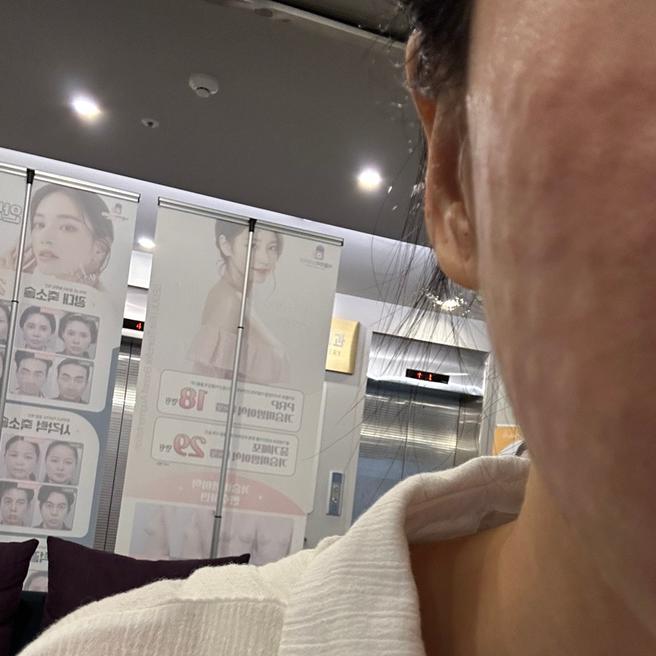 손기술 좋은 원장님 덕에 리쥬란 여기로 완전 정착했어요ㅎㅎ
