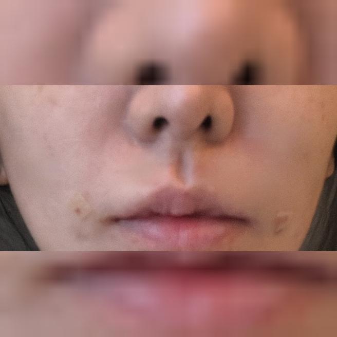 원하는 부위 딱 파악해서 잘 해주셨어요! 