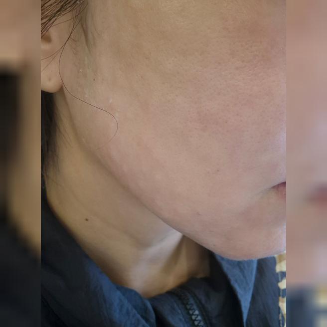 친절한 응대에 대기도 짧고 수면으로 편하게 받았습니다~!