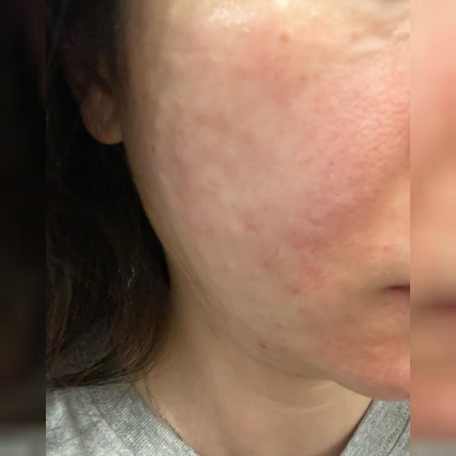 쥬란이랑 리쥬란 아이 같이 받았는데 이번에도 꼼꼼함에 감탄했어요~