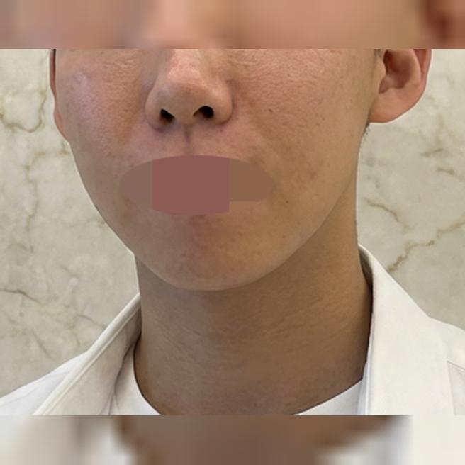 여름 지나고 피부 푸석해진 것 같아서 리투오 받으러 방문했습니다