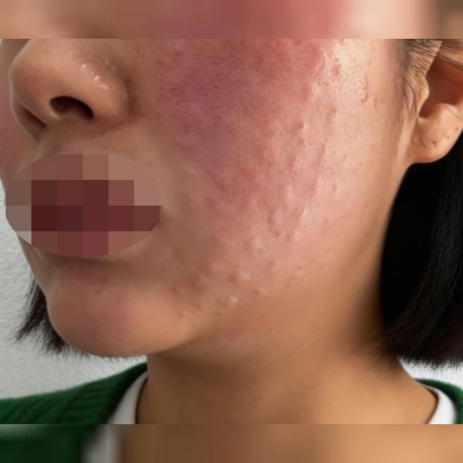 결혼식 앞두고 화장 잘 받는 피부 만들려고 수면으로 한번에 챙겼어요
