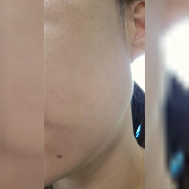 30대 중반부터 관리 시작했는데 피부 좋아져서 꾸준히 받으려고요!