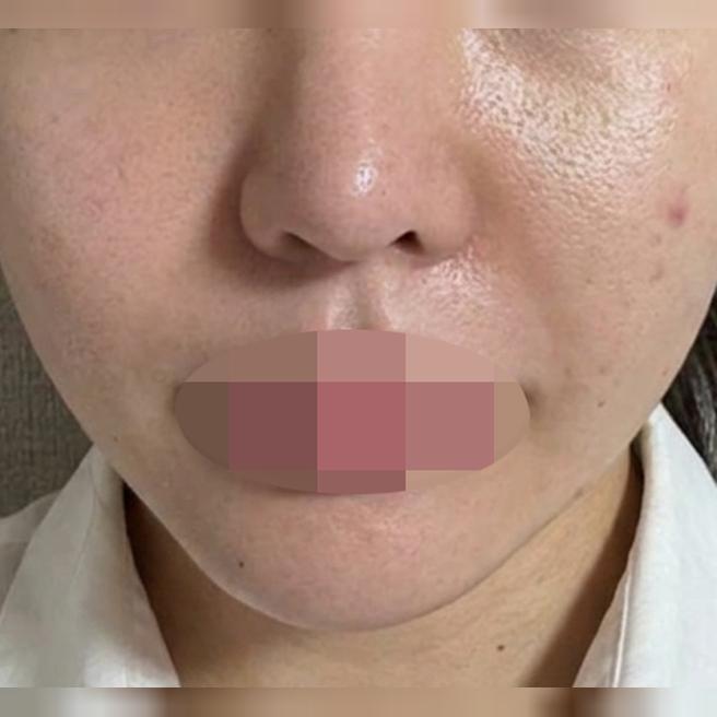 수면으로 편하게 받은 리쥬쎄라, 만족스러워서 추천드려요ㅎㅎ