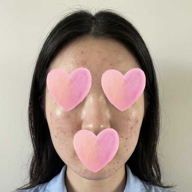 리투오 3일차인데 벌써 기대되는 거 저만 그래요?