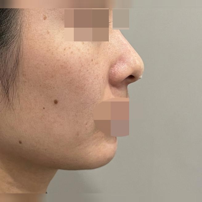 제 니즈에 맞게 최대한 맞춰주셔서 정말 만족스러운 결과예요~~