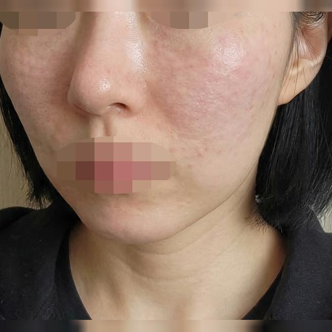 과잉 권유 없이 꼼꼼하게 해주셔서 좋았어요!!