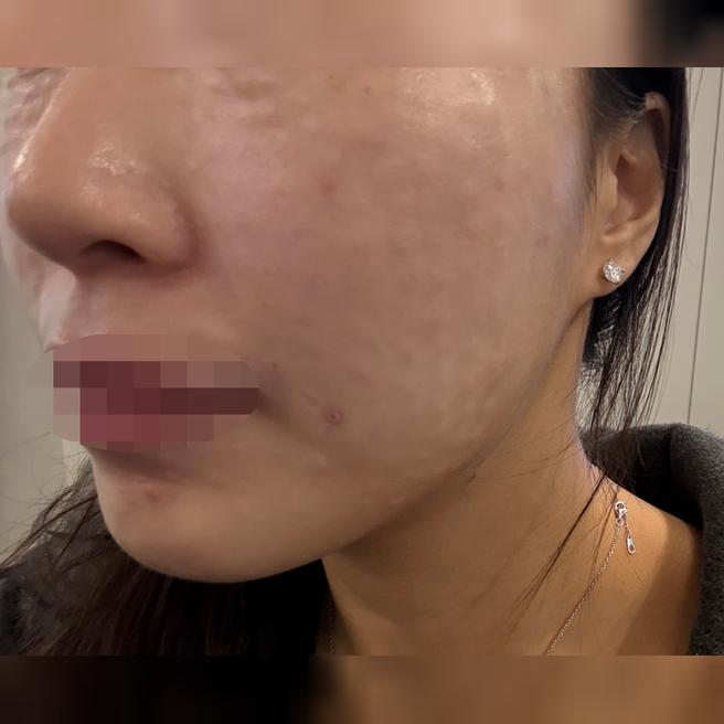 안 아프게 잘 놔주셔서 완전 강추!!