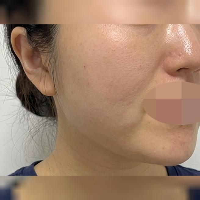 깨끗한 시설에 좋은 접근성까지 시술도 만족스러웠습니다~