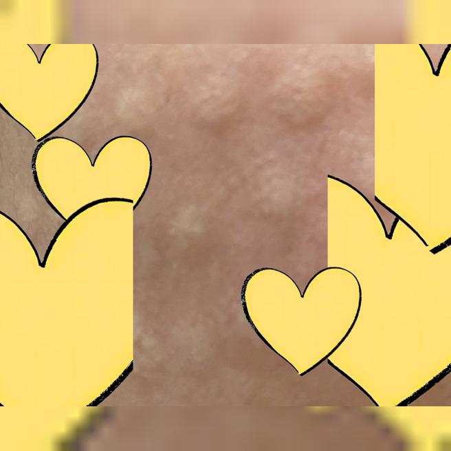 리쥬란 3일차, 생각보다 빠르게 가라앉았어요