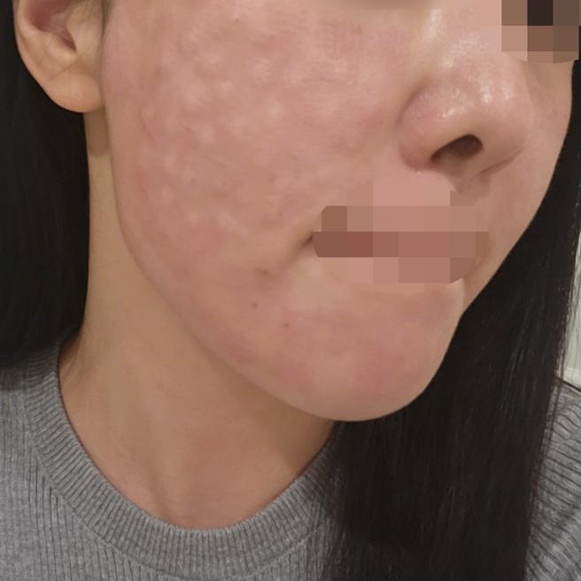 친구 추천으로 왔는데 역시 한국으로 오길 잘했어요 ㅎㅎ