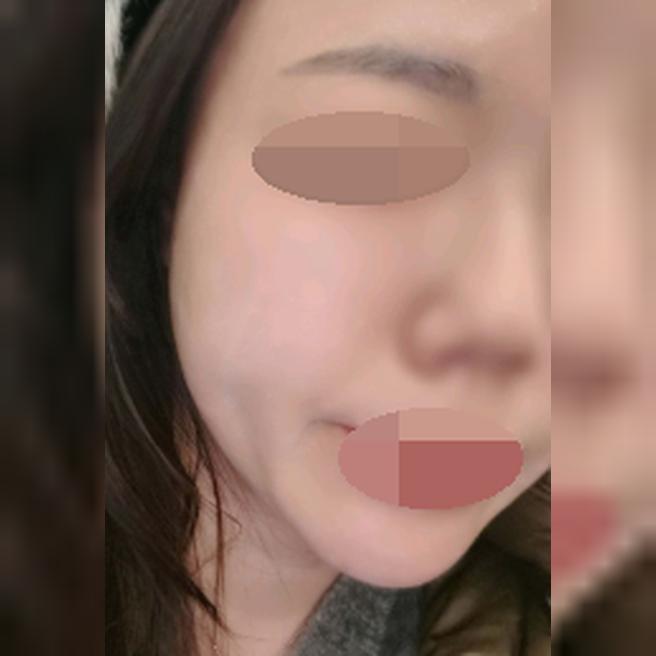 리쥬란 맛집이라 벌써 5회째 다니고 있어요 ㅎㅎ