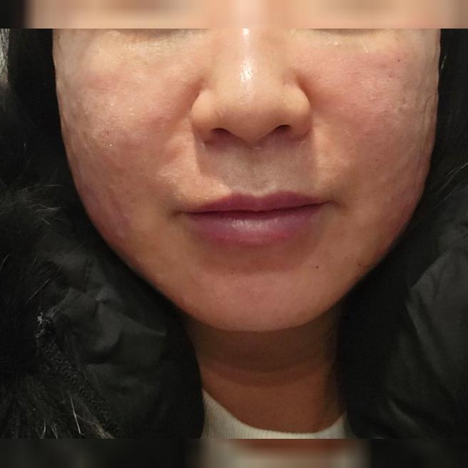 예약대로 진행되고 편해서 꾸준히 다녀보려고요~