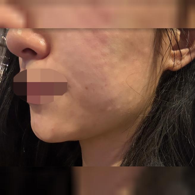 깔끔한 시설에 꼼꼼한 안내까지, 강남언니로 예약하길 잘했어요~><