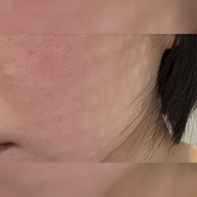 일본에서 방문했는데 응대도 시술도 만족스러워요!
