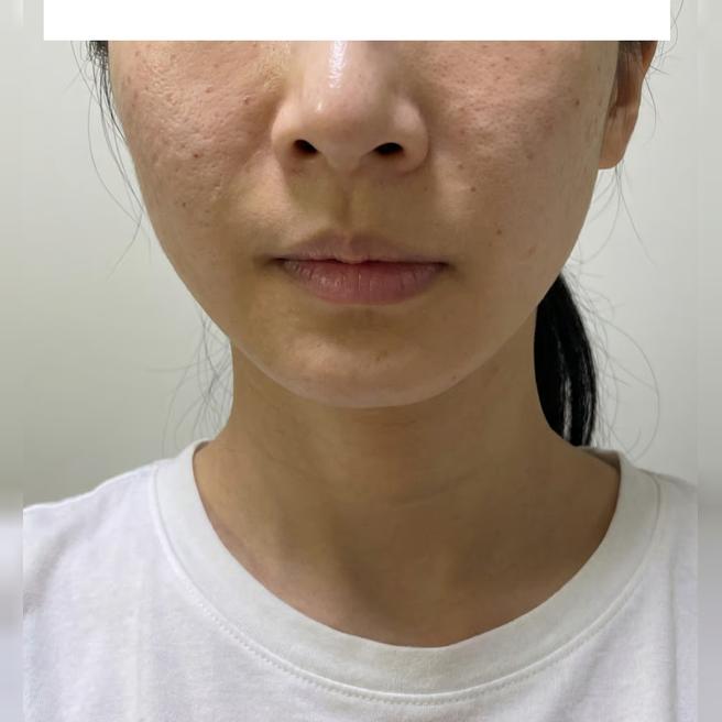 효과 너무 좋아서 만족합니다~