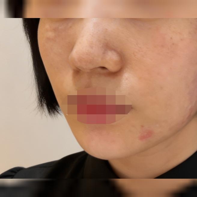 피부 건조함이랑 탄력 고민으로 리쥬베룩 새로 찾아봤어요~