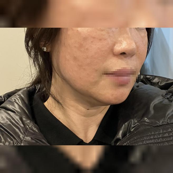 처음인데 효과 좋으면 꾸준히 받으려고 합니다~ 강남역과 가까워서 좋네요ㅎㅎ