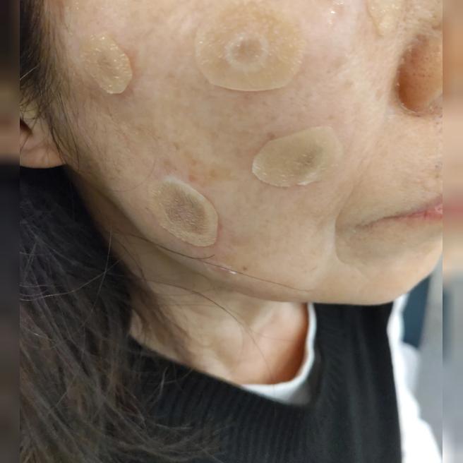 한국에서 처음 받았는데 좋아서 다음엔 다른 시술도 해보려고요~