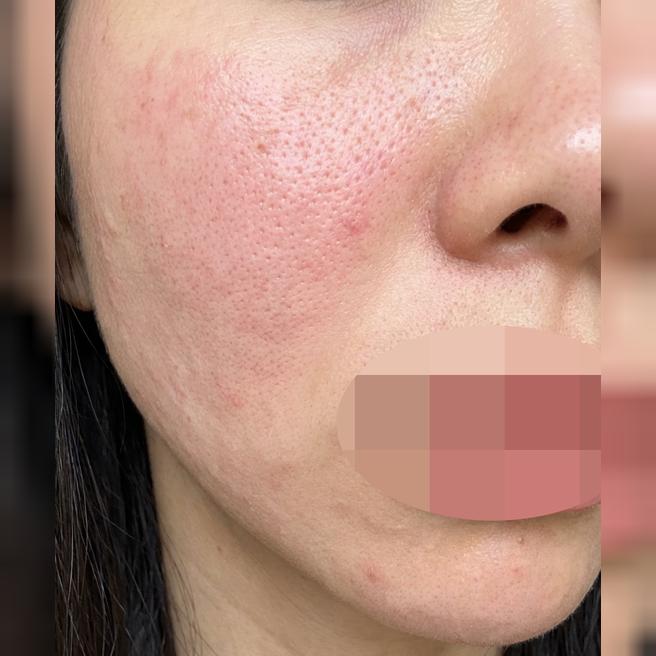 촘촘하게 잘 놔주시고, 대기 없이 빠른 진료 가능해서 좋네요~ㅎㅎ