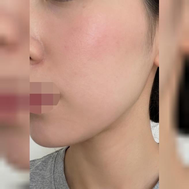 과하지 않게 꼭 필요한 부위만! 자연스러운 결과에 만족이에요~ㅎㅎ