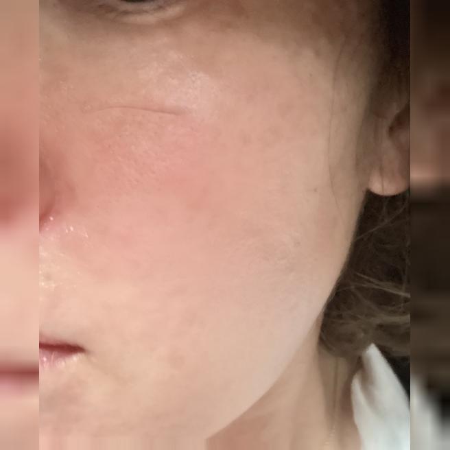 수면으로 리쥬베룩 가능한 곳 찾다가 후기 보고 방문했어요~