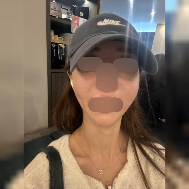 나이 들수록 꼭 받아야 할 스킨보톡스, 이번에도 만족이에요~